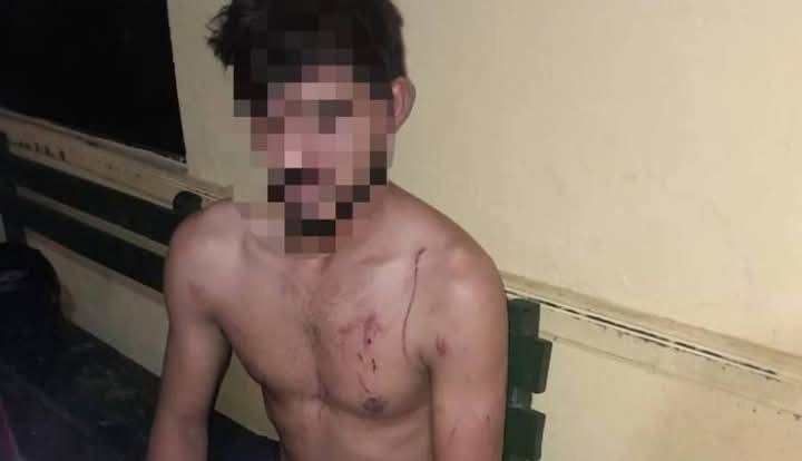 Hombre denuncia a su pareja por agresión física y verbal en Limpio