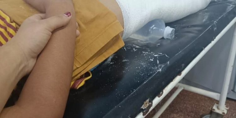 Niño fue agredido por un compañero de escuela y sufrió una fractura de rodilla