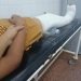 Niño fue agredido por un compañero de escuela y sufrió una fractura de rodilla