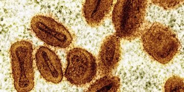 Brote de viruela símica en África ya no es una emergencia de salud global