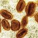 Brote de viruela símica en África ya no es una emergencia de salud global