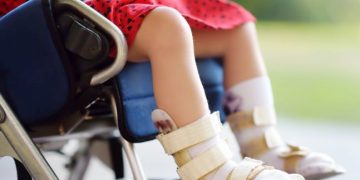 Familiares de personas con Atrofia Muscular destacan trabajo de FONARESS para ayudar en tratamientos