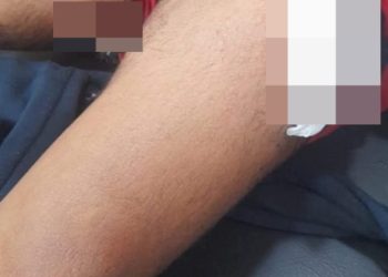 Ypané: atacaron a balazos a un joven en su propia casa