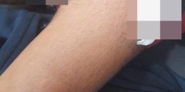 Ypané: atacaron a balazos a un joven en su propia casa