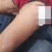 Ypané: atacaron a balazos a un joven en su propia casa