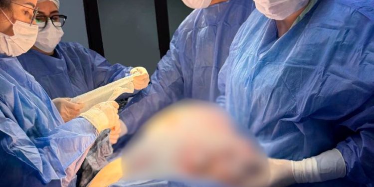 En Pedro Juan Caballero: extirpan tumor ovárico de 11 kilogramos