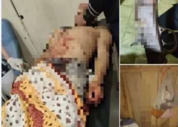 San Juan Nepomuceno: Hombre muere de un escopetazo en medio de una discusión entre hermanos