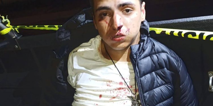 Presunto asaltante abatido y otro detenido tras tiroteo con la Policía en CDE