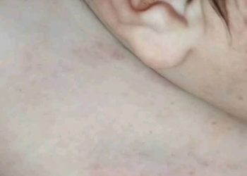 Investigan presunta agresión a un bebé por parte de su padre en Alto Paraná