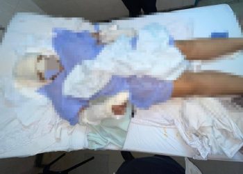 Brutal ataque con machete a una mujer en San Antonio