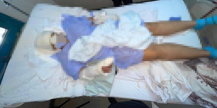 Brutal ataque con machete a una mujer en San Antonio