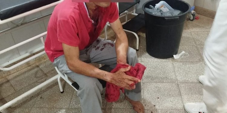 Yby Yaú: quedó con un cuchillo en el ojo tras una noche de tragos