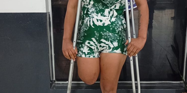 Aprehenden en flagrancia a una joven con discapacidad por hurtar cables