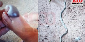 Niño de 2 años fue mordido por una serpiente yarará en Bella Vista Norte