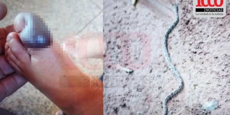 Niño de 2 años fue mordido por una serpiente yarará en Bella Vista Norte