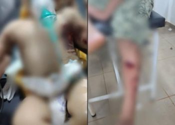 Explosión de pirotecnia deja tres niños heridos; una bebé permanece en UTI