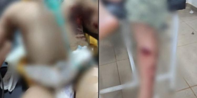 Explosión de pirotecnia deja tres niños heridos; una bebé permanece en UTI