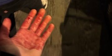 Dos hinchas del Chelsea acuchillados en Nápoles