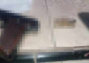 Mujer fue atacada a balazos en Encarnación