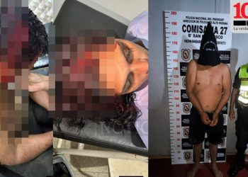 Discusión por polución sonora termina con pareja herida a machetazos en Hernandarias