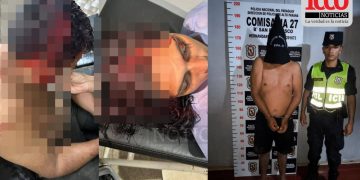 Discusión por polución sonora termina con pareja herida a machetazos en Hernandarias