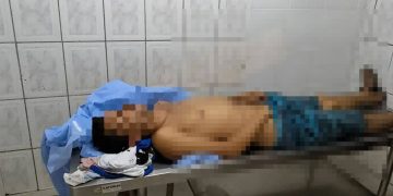 Joven muere tras recibir un disparo frente a un local nocturno en Zanja Pytã