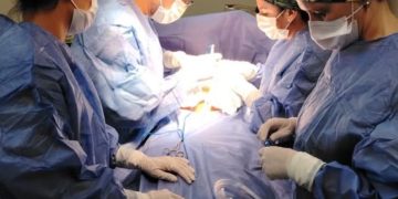 En Hospital General de San Lorenzo extraen tumor de ovario de 12 kilos