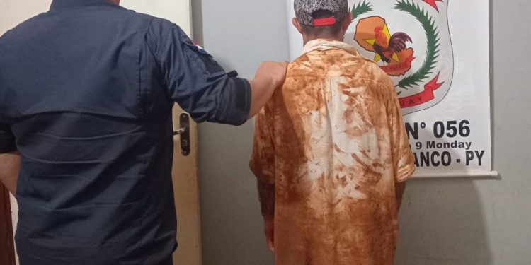 Detienen a hombre por presunto intento de feminicidio tras atacar a su expareja en Ciudad del Este