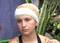 Mujer que perdió el cuero cabelludo en accidente pide ayuda para continuar su tratamiento