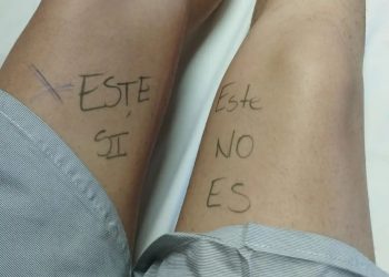 Por si acaso, doctor: paciente se señala la pierna correcta antes de la cirugía