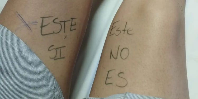 Por si acaso, doctor: paciente se señala la pierna correcta antes de la cirugía