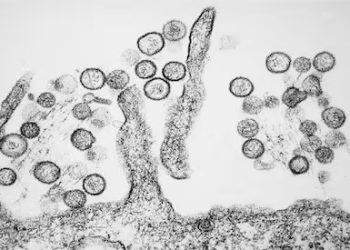 Salud Pública aclara diferencias entre el hantavirus local y el brote detectado en un crucero