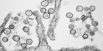 Salud Pública aclara diferencias entre el hantavirus local y el brote detectado en un crucero