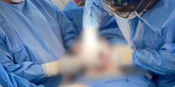 Médicos de Villa Elisa extraen con éxito un mioma de casi cuatro kilos a una paciente