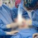 Médicos de Villa Elisa extraen con éxito un mioma de casi cuatro kilos a una paciente