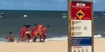 Mujer y niño, víctimas de tiburones: fueron atacados y sufrieron amputaciones
