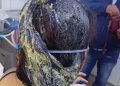Por celos, hombre derramó pegamento para zapatos en el cabello a su pareja