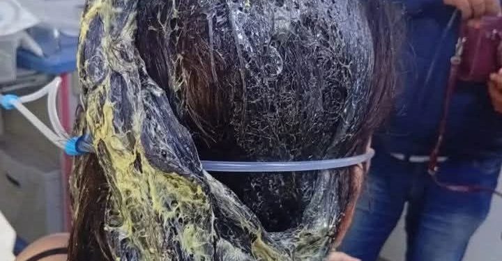 Por celos, hombre derramó pegamento para zapatos en el cabello a su pareja