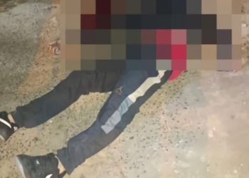 Joven de 19 años muere tras recibir un disparo en el rostro en Ciudad del Este