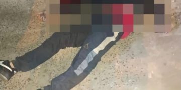 Joven de 19 años muere tras recibir un disparo en el rostro en Ciudad del Este