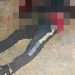 Joven de 19 años muere tras recibir un disparo en el rostro en Ciudad del Este