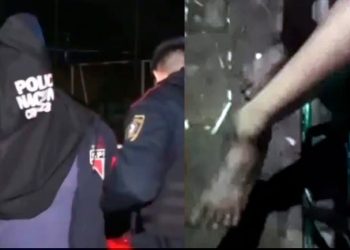 Mujer sufrió fractura en una pierna tras presunta agresión de su pareja en J. Augusto Saldívar