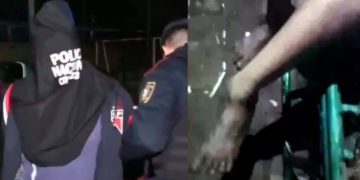 Mujer sufrió fractura en una pierna tras presunta agresión de su pareja en J. Augusto Saldívar