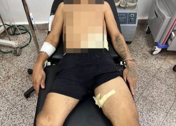 Recluso resultó herido con un arma blanca durante una pelea