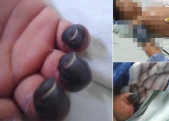 Niño de 5 años permanece internado en estado delicado y familiares denuncian presunta negligencia médica