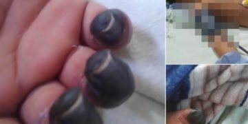 Niño de 5 años permanece internado en estado delicado y familiares denuncian presunta negligencia médica