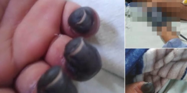 Niño de 5 años permanece internado en estado delicado y familiares denuncian presunta negligencia médica