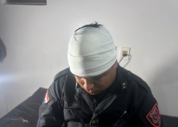 Hombre atacó con machete a un policía durante intervención por violencia familiar en Luque
