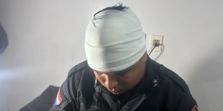 Hombre atacó con machete a un policía durante intervención por violencia familiar en Luque
