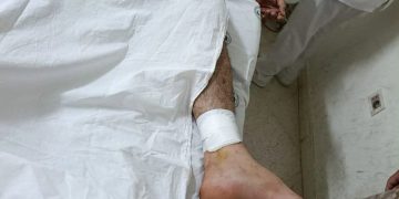 Intentaba cazar a un carpincho y se disparó accidentalmente